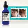 Picture of Macadamia Professional Éprouvage Reviving Scalp Serum, 2 Fl Oz