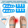 Picture of Premium Gel Toe Separators, Straighteners & Spacers | Hammer Toe & Bunion Corrector For Men & Women | Use for Pedicure, Yoga & Running (US Shoe Size 10 & Above)