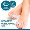 Picture of Povihome 10 Pack Pinky Toe Separator and Protectors, Triple Gel Toe Separators for Overlapping Toe, Curled Pinky Toes Separate and Protect