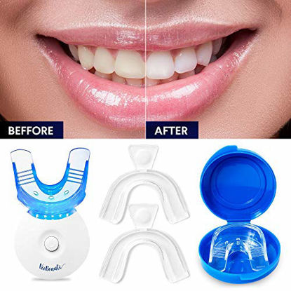 Picture of VieBeauti Teeth Whitening Kit - 5X LED Light Tooth Whitener with 35% Carbamide Peroxide, Mouth Trays, Remineralizing Gel and Tray Case - Built-In 10 Minute Timer Restores Your Gleaming White Smile