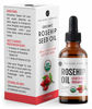 Picture of Rosehip Seed Oil by Kate Blanc. USDA Certified Organic, 100% Pure, Cold Pressed, Unrefined. Reduce Acne Scars. Essential Oil for Face, Nails, Hair, Skin. Therapeutic AAA+ Grade. (1 fl oz)