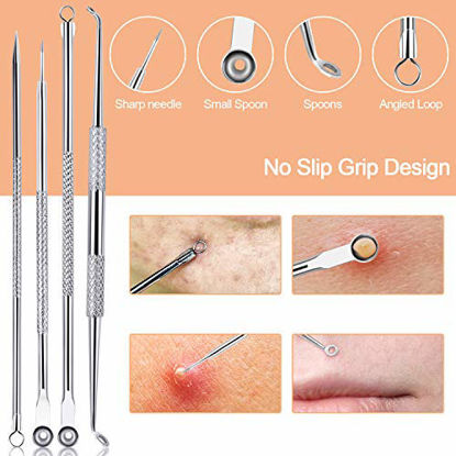 Picture of Blackhead Remover Pimple Popper Tool Kit 10 Pcs, Comedone Pimple Extractor Tool, Acne Kit for Blackhead, Whitehead Popping, Zit Removing