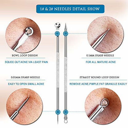 Picture of 6PCS Dual Heads Blackhead Remover, Pimple Comedone Extractor, Acne Whitehead Blemish Removal Kit, Premium Stainless Steel, Risk Free For Face Skin, With Portable Box