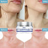 Picture of HSBCC Neck Firming Cream with Peptides,Neck Cream,Neck Moisturizer Cream,Anti Wrinkle Anti Aging Neck Lifting Cream for Neck, Advanced Stem Cell + Collagen Formula For Tightening & Lifting Sagging Ski