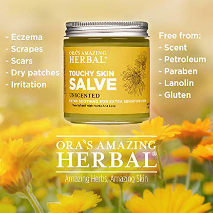 Picture of Natural Touchy Skin Healing Salve Intensive Eczema Treatment Lotion for Sensitive Skin Paraben Free Eczema Lotion with Organic Calendula, Coconut Oil