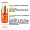 Picture of Noche Y Dia Vitamin C Serum - Daily Anti Aging Formula for Face & Skin - Brighten & Even Skin Tone - Reduce Appearance Of Wrinkles, Dark Circles, Fine Lines, Sun Damage - Boost Collagen - 1.02 oz