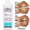 Picture of Lee Beauty Professional Callus Remover Extra Strength Gel for Feet, At Home Pedicure Results, 8 Oz