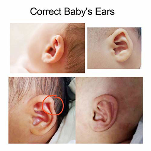 GetUSCart- Baby Auricle Valgus Correction Patch, Newborn Baby Ear ...