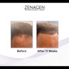 Picture of Zenagen Revolve Thickening and Hair Loss Shampoo Treatment for Men, 32 oz.