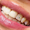 Picture of Gemzeez: The Origianl DIY Temporary Tooth Gemz Starter Kit (Crushed Ice)