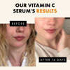 Picture of Vitamin C Face Serum - Hyaluronic Acid, Retinol, & Vit E - Anti Aging Facial Brightening Serum for Skin Care - Timeless Pure Vitamin C Serum for Face Dark Spots, Vit C Serum Oil, Face Serum for Women