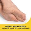 Picture of Dr. Scholl’s Severe Cracked Heel Repair Restoring Balm 2.5oz, with 25% Urea for Dry, Cracked Feet, Heals and Moisturizes for Healthy Looking Feet, Foot Care, Epsom Salt Soothes, Safe for Diabetics