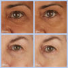 Picture of skyn ICELAND Hydro Cool Firming Eye Gels: Under-Eye Gel Patches to Firm, Tone and De-Puff Under-Eye Skin, 4 Pairs