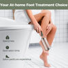 Picture of Easkep Foot File Foot Scrubber Pedicure