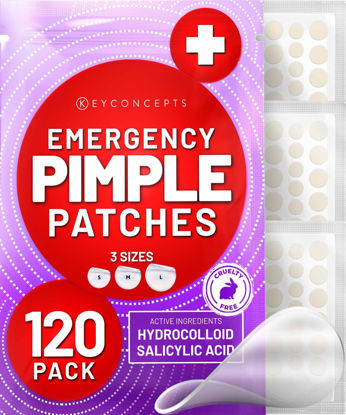 Picture of KEYCONCEPTS Pimple Patches (120 Pack), Salicylic Acid Acne Patches with Tea Tree Oil - Zit Patch and Pimple Stickers for Face - Salicylic Acid Acne Dots