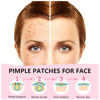 Picture of Star Pimple Patch 108 Counts, Pimple Patches for Face Pimple Patches Stars Hydrocolloid Acne Patches Zit Patches for Face Cystic Acne Treatment Blemish Spot Treatment for All Skin Type