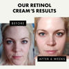 Picture of Anti Wrinkle Retinol Cream for Face - Anti Aging Cream w/Vitamin A Cream for Face - Retinol Moisturizer-Night Cream with Retinol and Hyaluronic Acid Face Moisturizer-Organic Retinol Cream