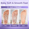 Picture of Foot Peel Mask (2 Pairs) - for Baby Soft Skin Remove Dead Skin, Dry, Cracked Feet & Callus, Spa, Made with Aloe Vera Extract Women and Men Peeling Exfoliating, Lavender